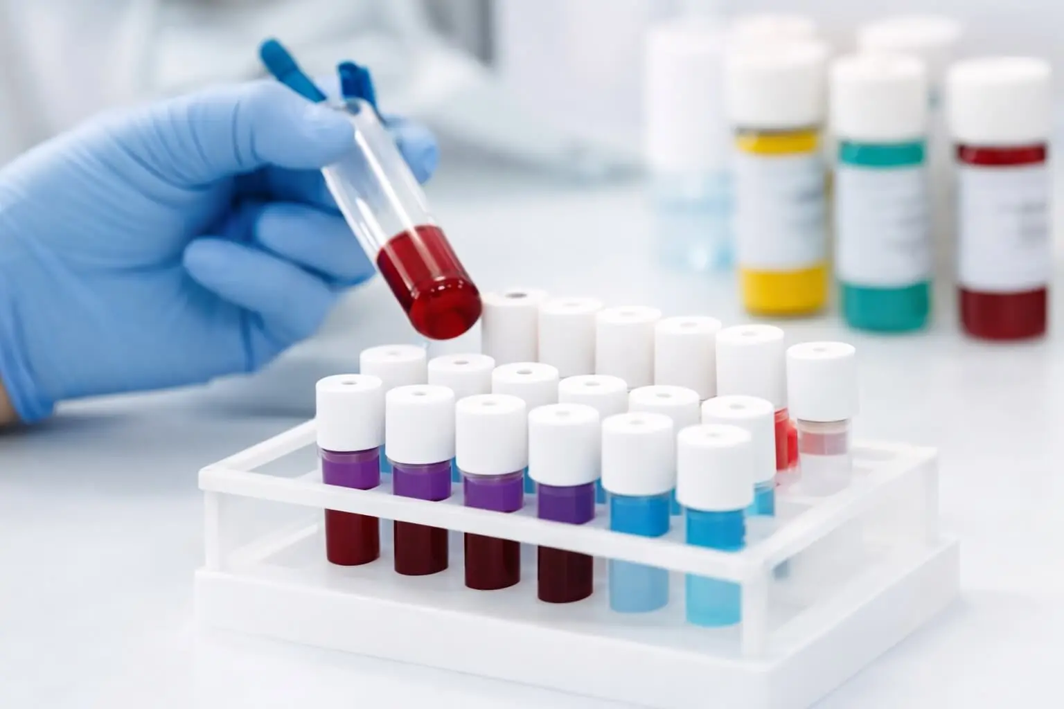 Lab test ECG at home Electronic City Bangalore